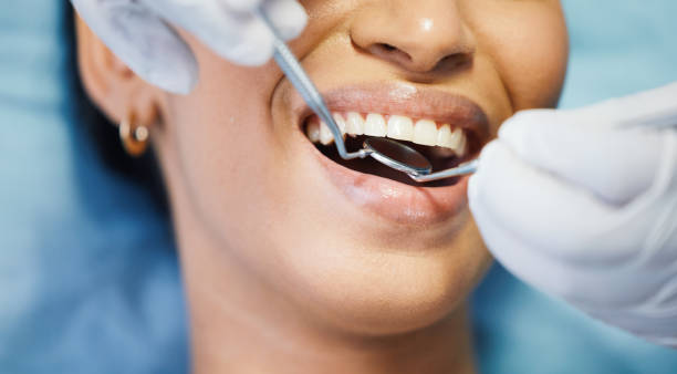 Best Emergency Treatment for Dental Infections or Abscesses in Bloomingdale, TN
